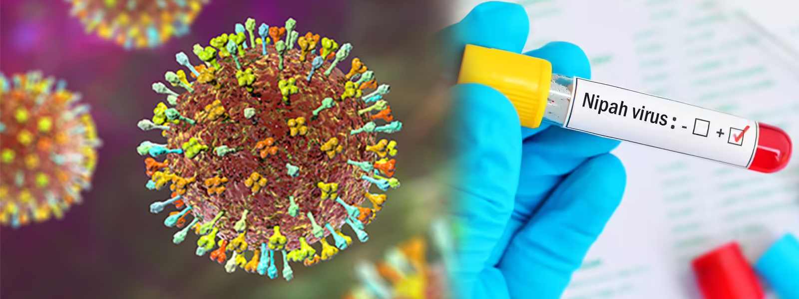 නිපා වෛරසය මෙරටට බලපායිද?